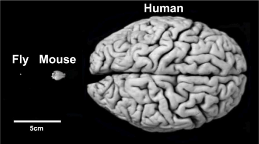 Brain comparisons
